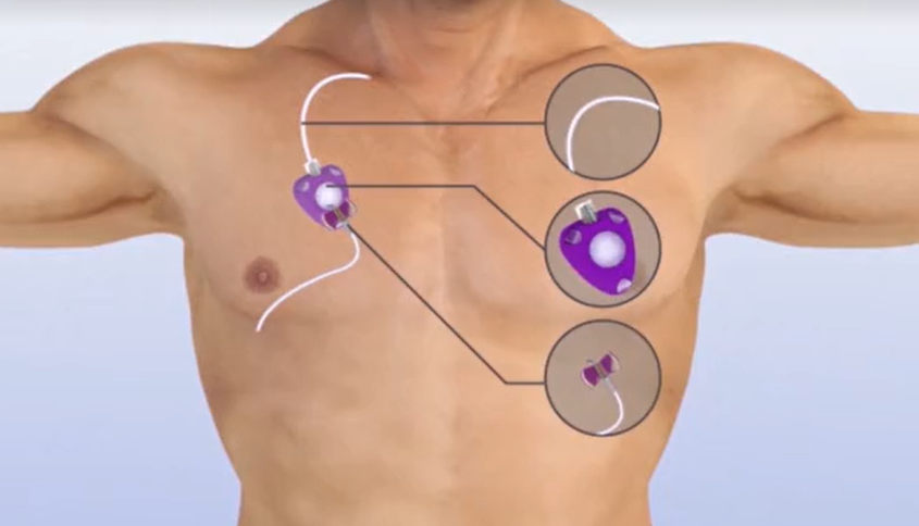 62eb307bc924f.png 62eb307bc924f.png