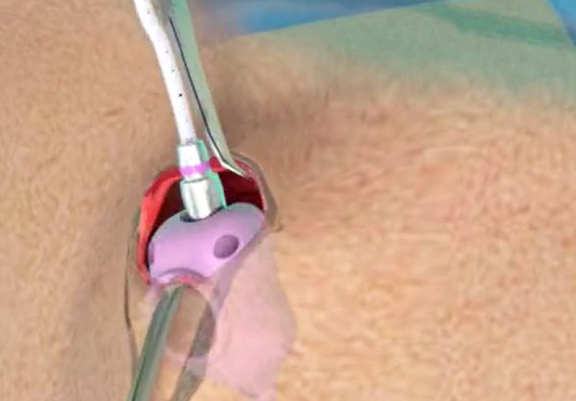 62eb30aaeaeff.png 62eb30aaeaeff.png